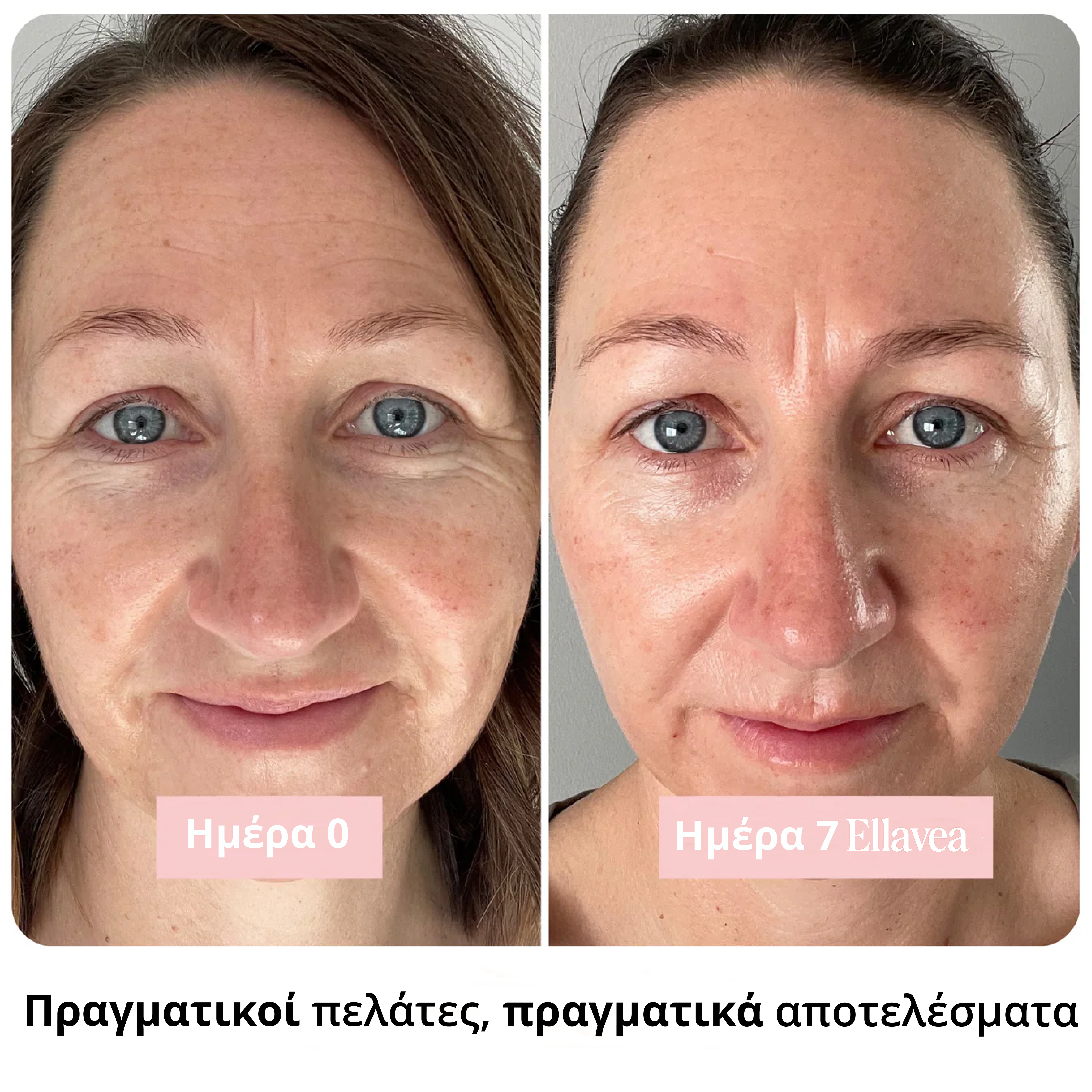 Ραβδί Καθαρού Κολλαγόνου