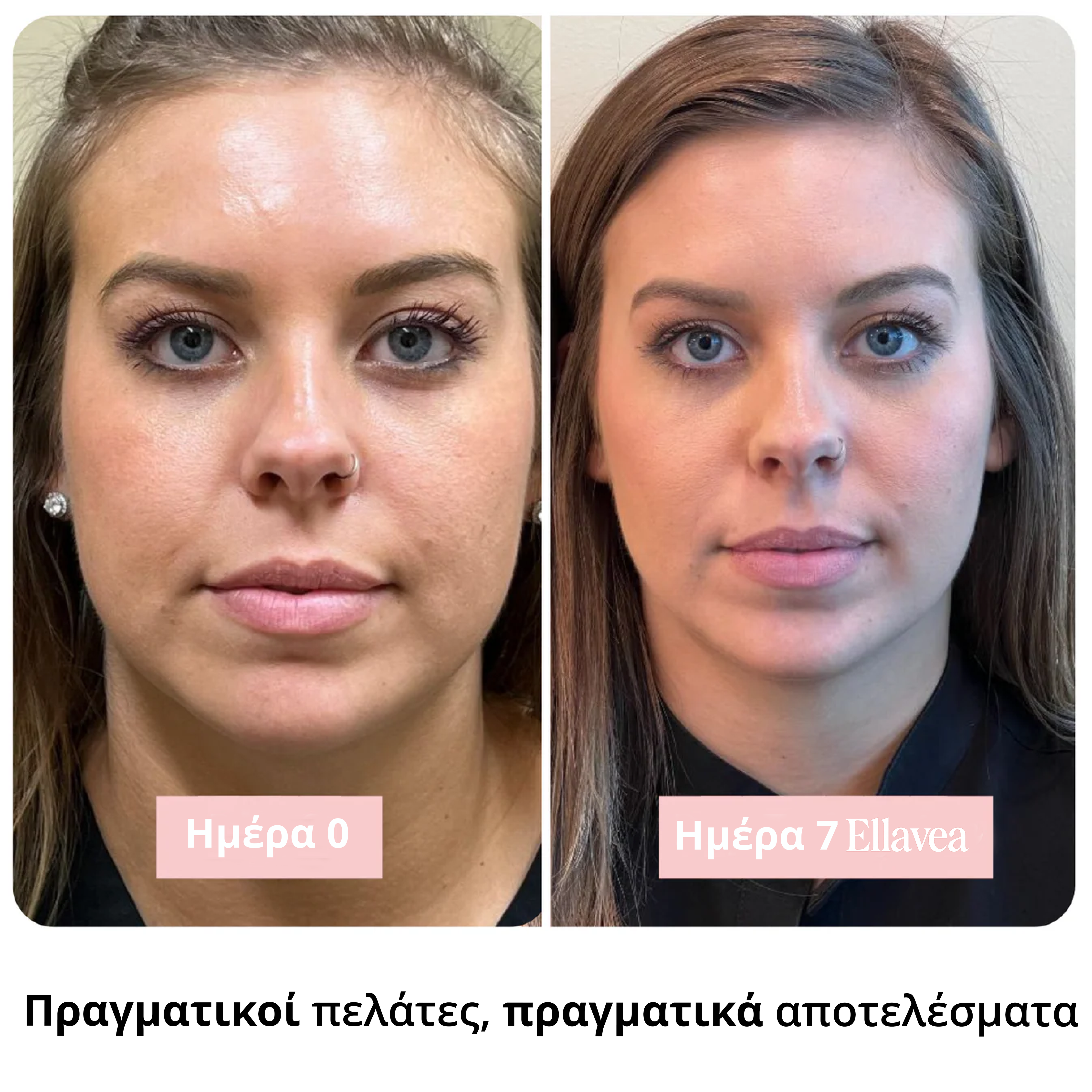 Ραβδί Καθαρού Κολλαγόνου