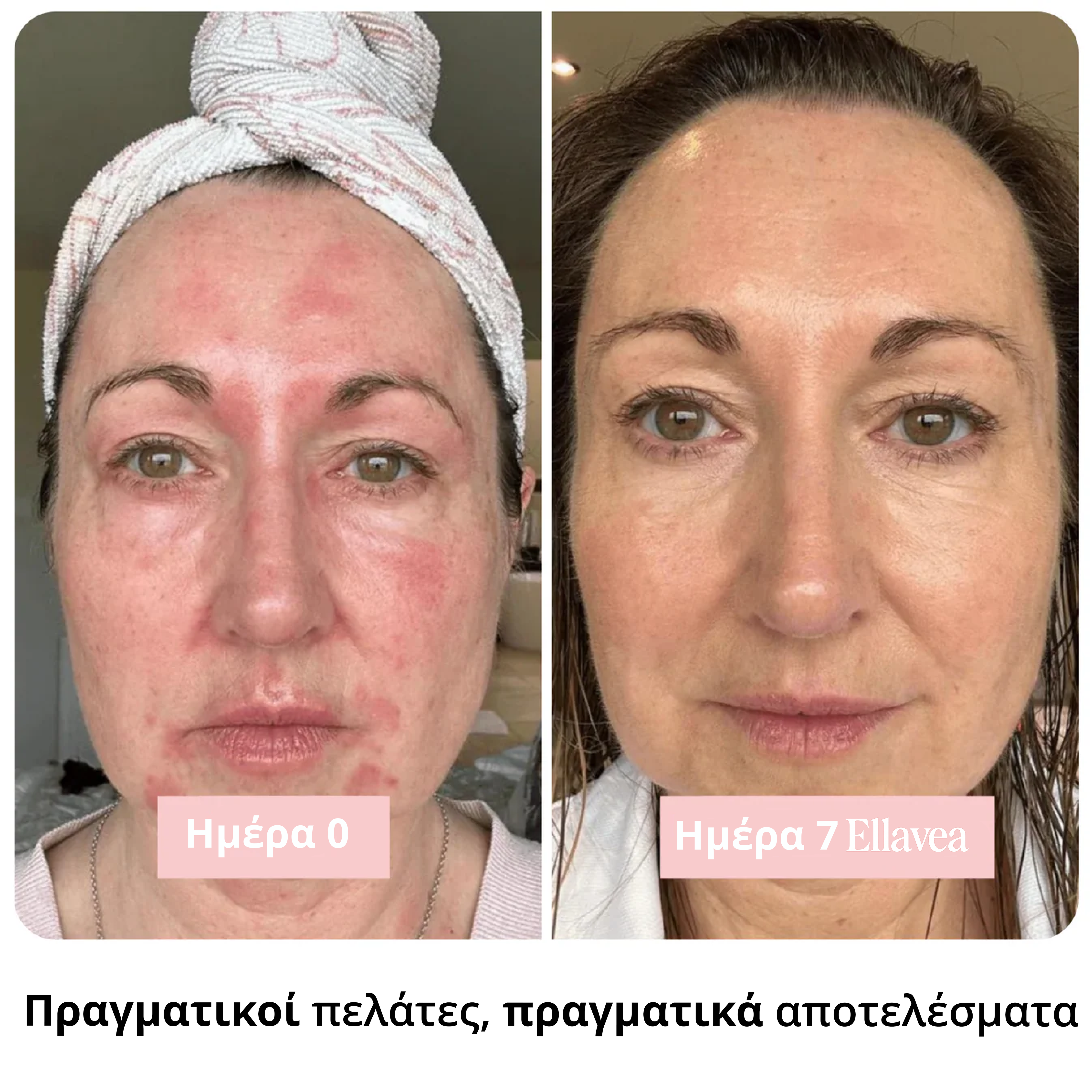 Ραβδί Καθαρού Κολλαγόνου